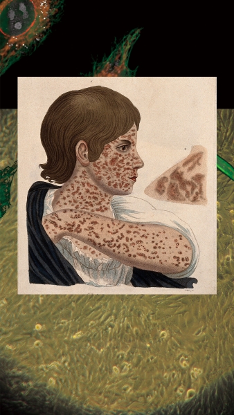 MUNUS–免疫與社群的當代治癒術｜吳虹霏｜國藝會補助成果檔案庫